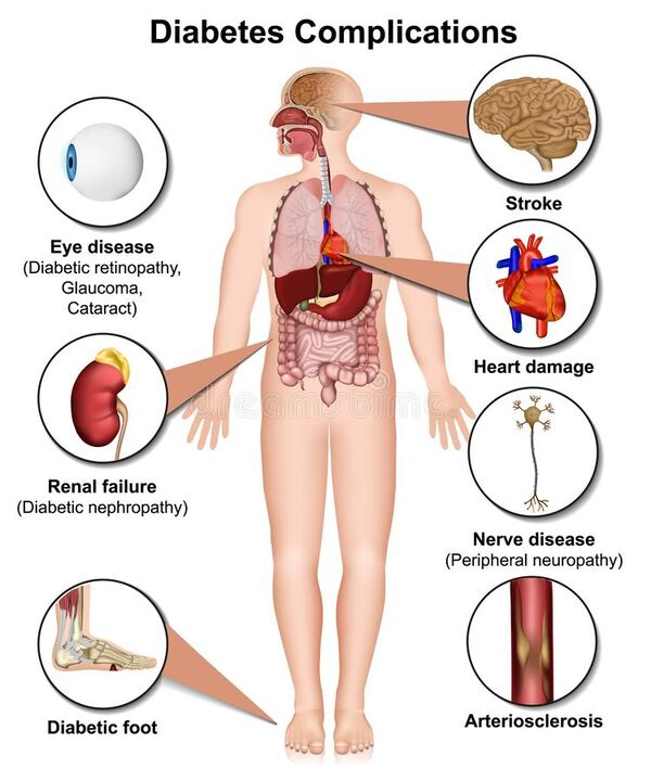 Consecuencias da diabetes